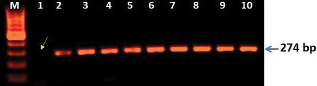 3D analysis showing microdeletion of Y-chromosome regions (AZFc). Polymerase chain reaction (PCR)-based analysis was carried out the mutation of SY255 STS marker consist of 126 bp band is completely lost lane-1 (arrow) and lane 2–8 showing lack of mutation when compared with controls (lane 9–10). The amplified PCR products were analyzed on agarose gel (1.5%) electrophoresis and characterized after staining with EtBr using GelDoc system (BioRad USA).