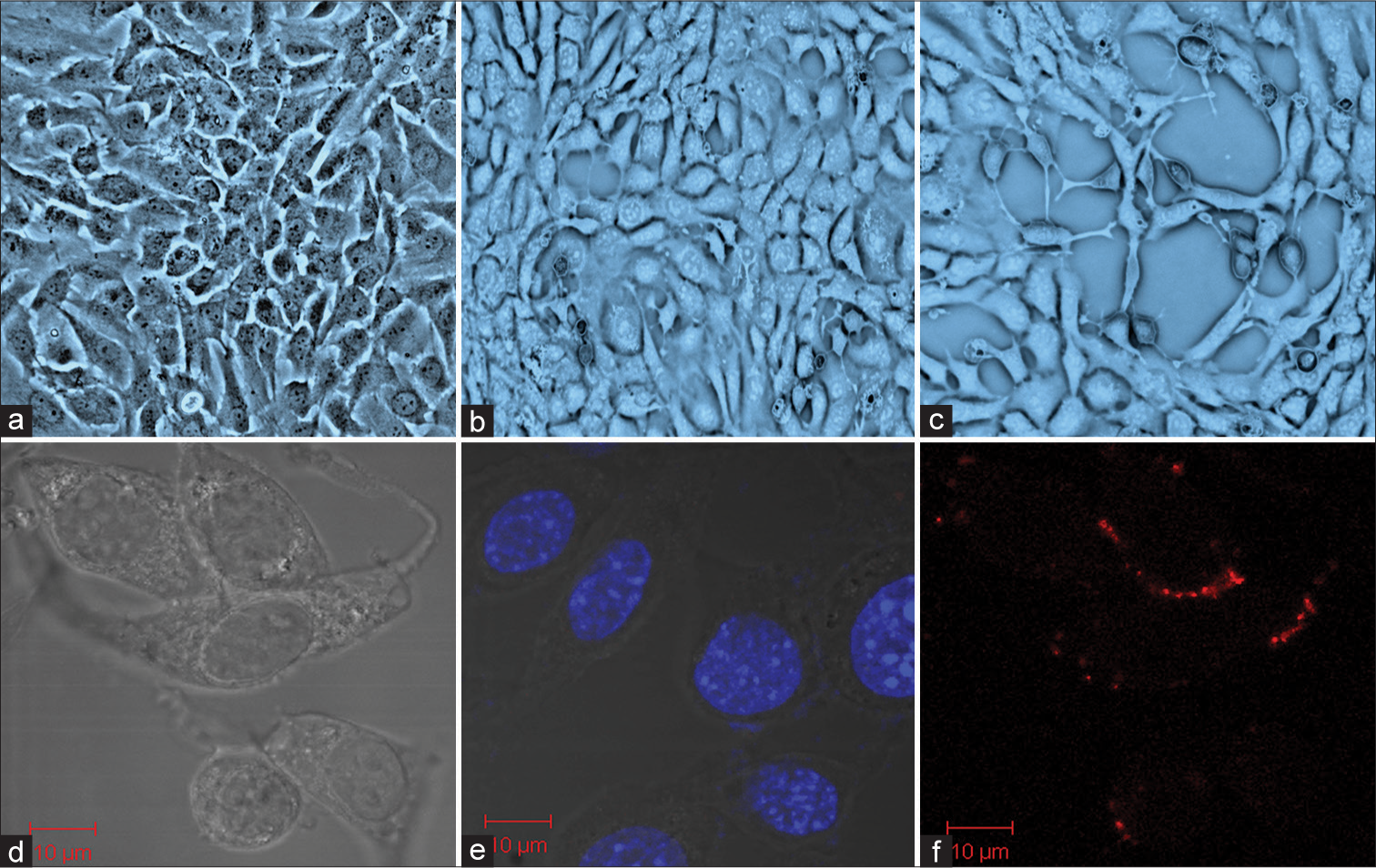 Mouse spermatogonia epithelial (GC-1 spg) cells exposed to Ultra-fine particulate matter (UFPM) (a) control, (b) GC-1 spg cells were treated with UFPM for 24 hours, and (c) GC-1 spg cells exposed to UFPM at 72 hours. Microsopic images showing uptake of UFPM by GC1-spg cells (d) Control of GC-1 spg cells, (e) accumulation of UFPM at 24 hours, and (f) uptake of UFPM by GC-1 spg cells at 72 hours. Scale bar, 10 μm. UFPM: Ultra-fine particulate matter.