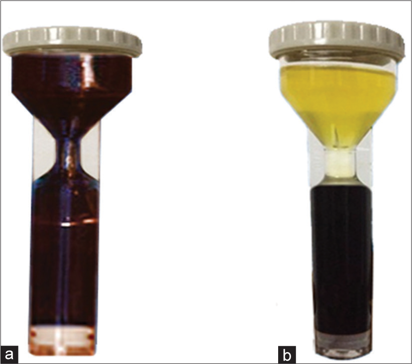 (a) Preparation of platelet-rich plasma (PRP). (b) Prepared PRP intrauterine infusion within 30 min of its preparation.