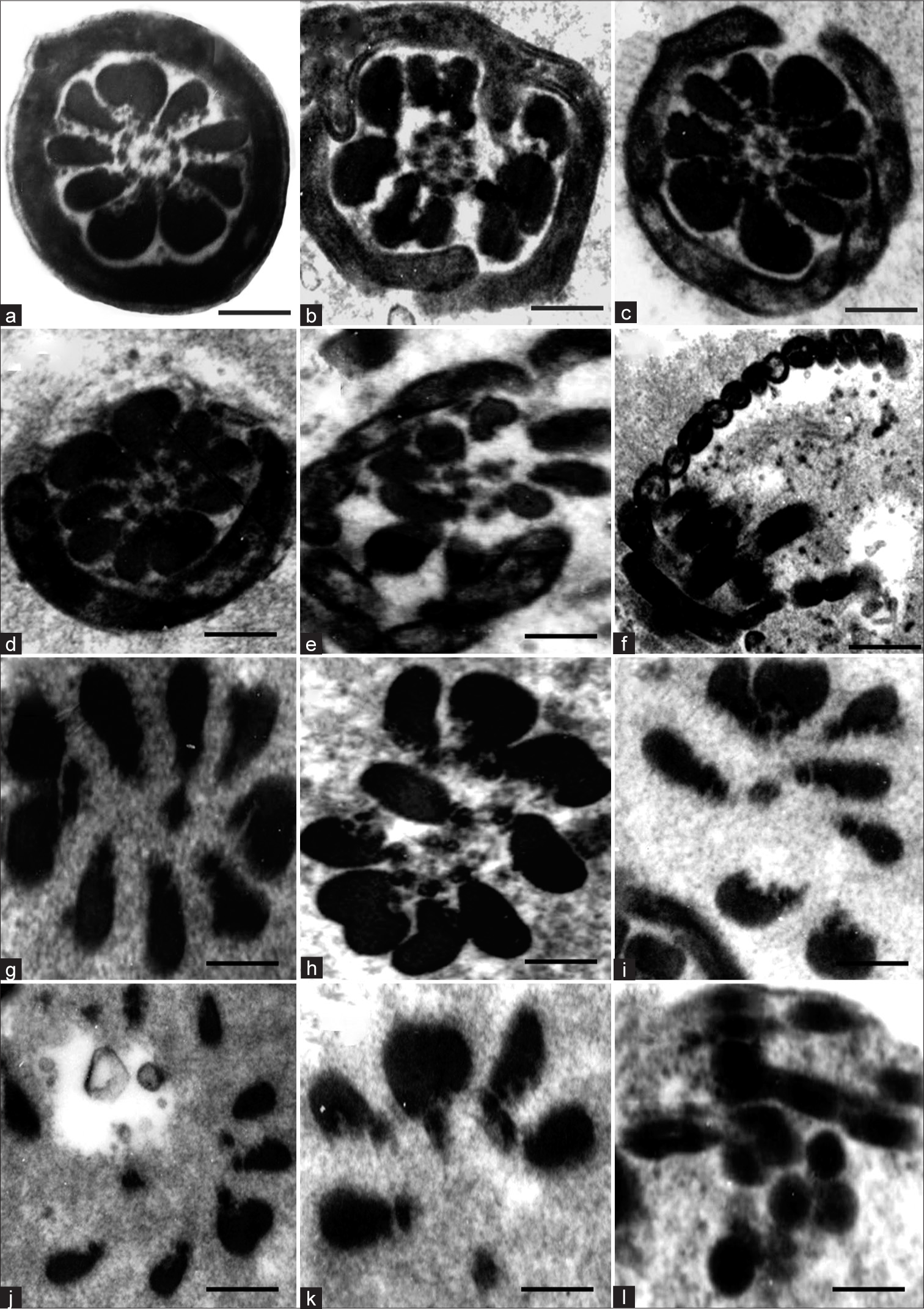 (a) Transmission electron micrograph (TEM) of Transverse section (TS) of mid-piece of control sperm. (b–l) TEM of mid-piece of matrix-embedded spermatozoa in disintegration, showing the tentative sequence of changes. (g–l) Suggests that outer dense fibers are rather resistant to disintegration. Scale bar a–e 0.3 μm, f 0.4 μm, g-l 0.25 μm.