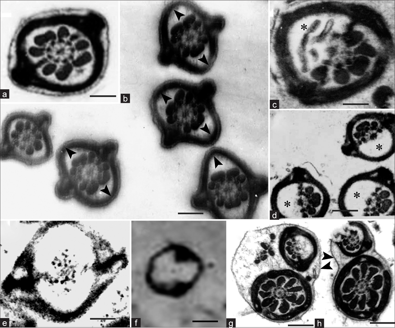 (a) Transmission electron micrograph (TEM) of Transverse section (TS) of principal piece of control sperm. (b–h) TEM of TS of principal piece of flagellum of matrix-embedded spermatozoa in disintegration. (b) fibrous sheath (FS) is lifted off (arrowheads) from the axoneme-outer dense fiber (ODF) complex; (c) one such spermatozoon magnified (asterisks show disintegrating ODFs); (d) complete disintegration of the ODFs on one side (asterisks); (e) complete disintegration of the ODFs on both sides; (f) complete disintegration of the ODFs and axoneme indicating that FS is more resistant to the disintegration. (g and h) TEM of sperm flagellum, which is folded and fused, could be mistaken for matrix-embedded spermatozoa. Note the intact plasma membranes (arrowhead). Scale bar a, 0.6 μm, b, d, f–h, 0.8 μm, c, e, 0.4 μm.
