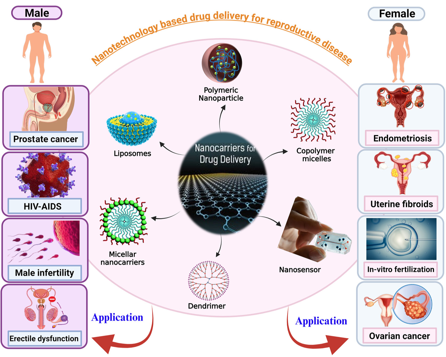 A pictorial representation of different nanocarriers used for treatment of male and female reproductive diseases. HIV: Human immunodeficiency virus, AIDS: Aquired immunodeficiency syndrome