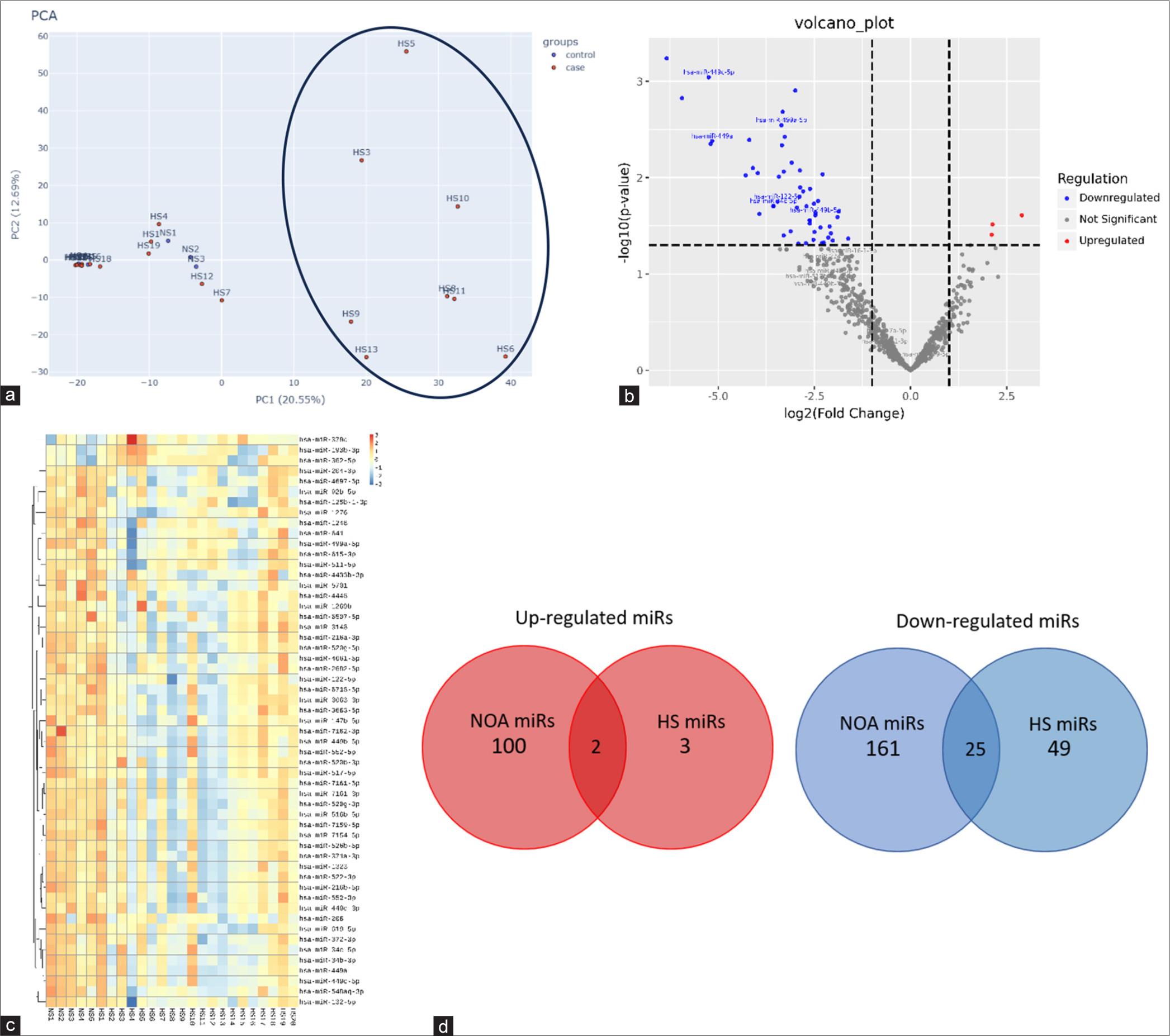 Analysis of testicular miRs in iHS pathology: (a) Principal component analysis (PCA) plot showing 8 HS samples (marked with oval) showing maximum variability compared to the 5 NS samples, (b) Volcano plot of all significantly upregulated and downregulated miRs with Log2 Fold change cut-off >1 (c) Heatmap representation of DE miRs (49 downrwgulated and 3 upregulated) in 20 iHS and 5 NS patients. (d) Venn diagram showing common up and downregulated miRs in NOA versus iHS patients. PCA: Principle component analysis, NS: Normospermatogenesis, NOA: Non obstructive azoospermia, HS: idiopathic Hypospermatogenesis